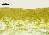 Sezione trasversale a livello di un soro di organi pluriloculari